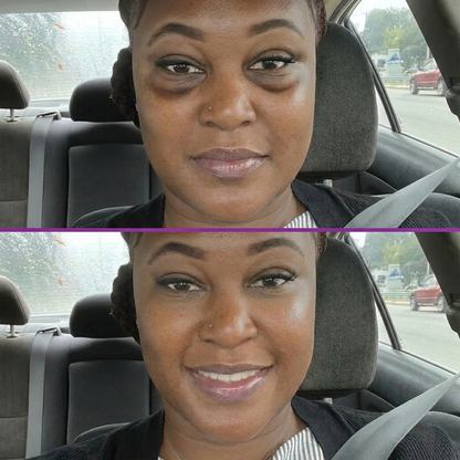 Velura™ Beauty Eye Firming Gel